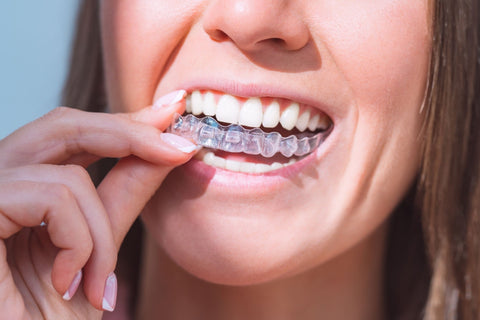 How Long Does Clear Aligner Treatment Take? A Step-by-Step Timeline