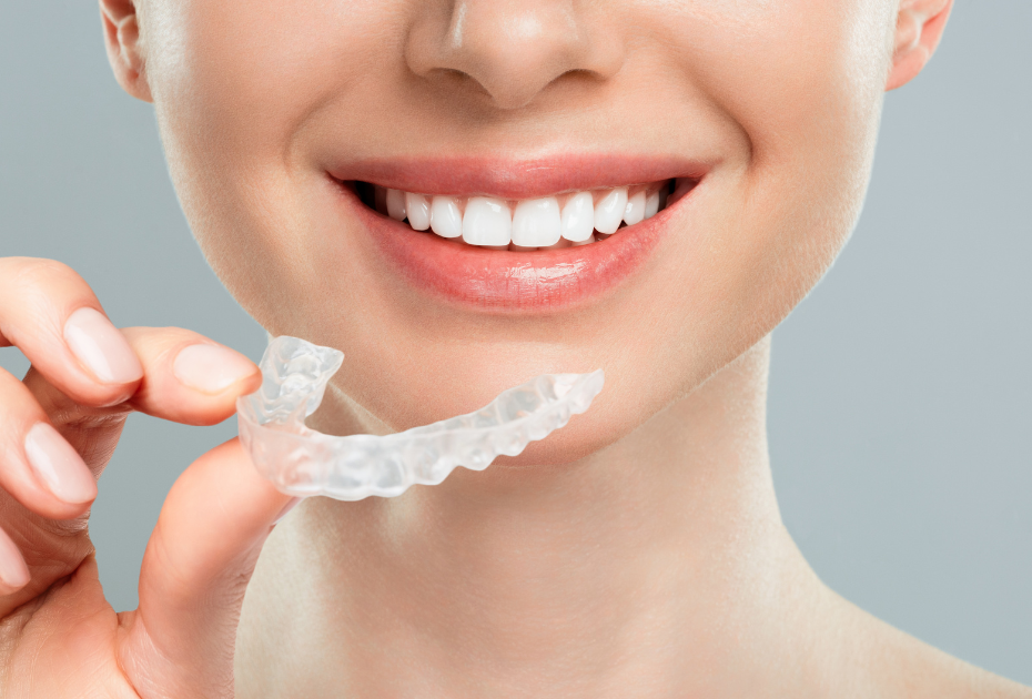 Clear Aligners vs. Ceramic Braces Cost in Australia