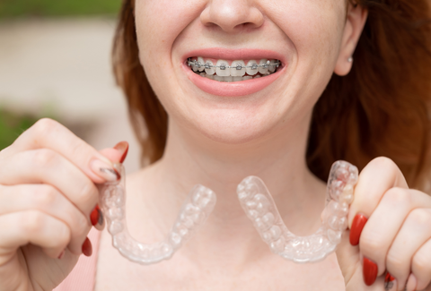 Clear Aligners vs Ceramic Braces: Which Is More Comfortable?