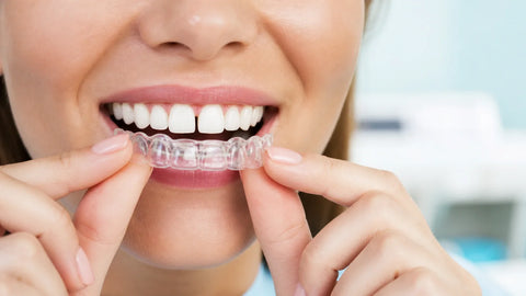 Can Clear Aligners Close Gaps in Teeth (Diastema)?