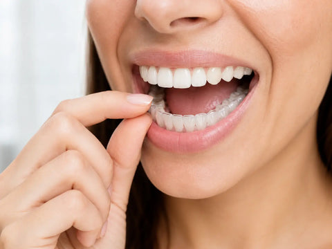 Can Clear Aligners Fix Crossbite? A Simple Guide for Australians