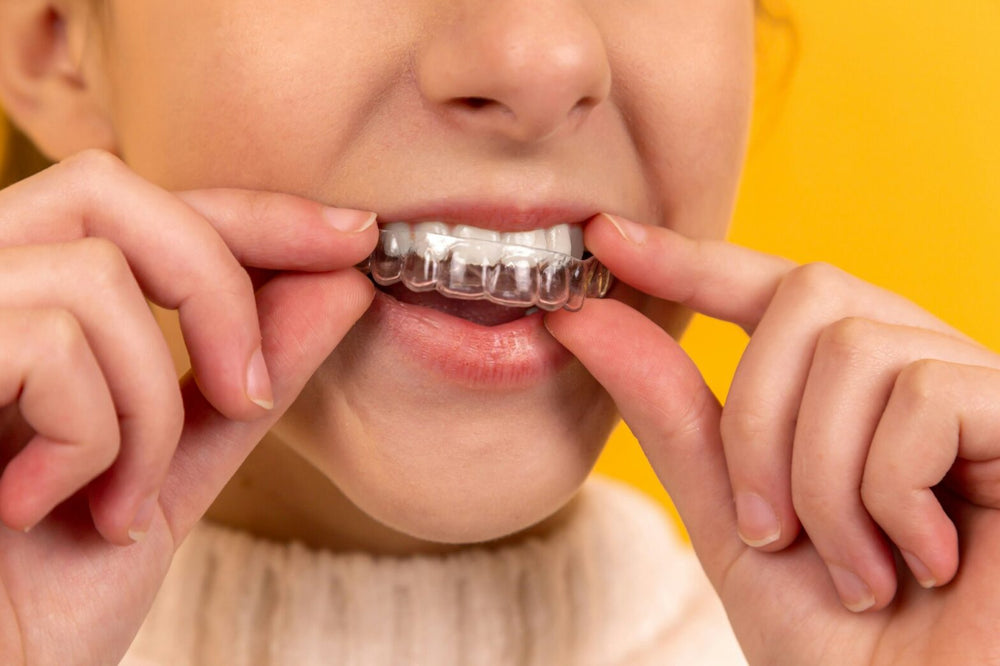 Clear Aligners Cost in Australia: What's Included With Smileie?