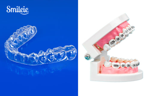 Modern Solutions for Straight Teeth: Choosing Aligners & Braces 2025